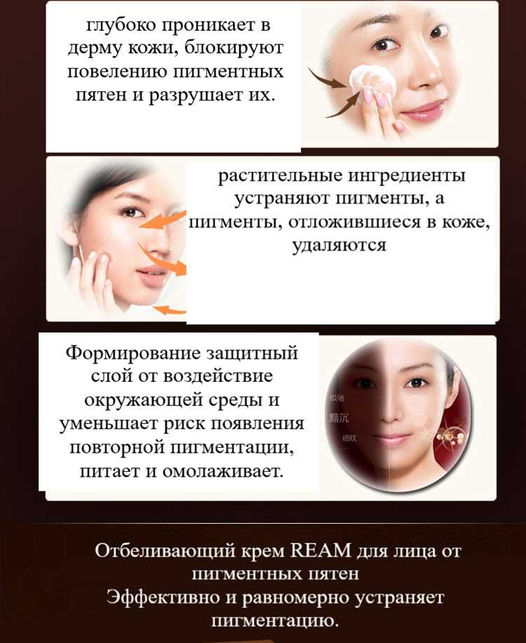 Как избавиться от пигментных пятен
