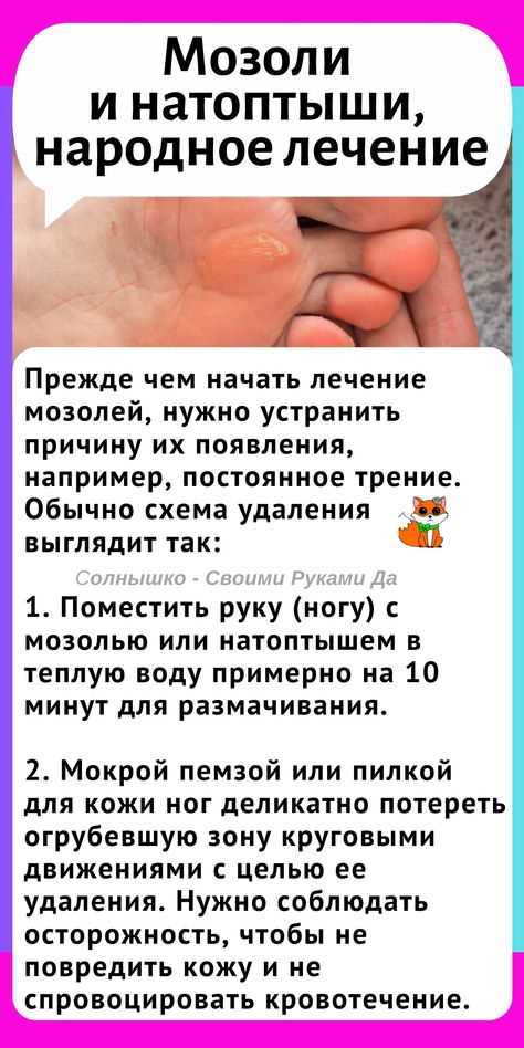 Народные методы: работают ли они на самом деле