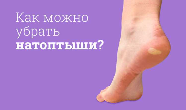 Какие средства из аптеки помогают убрать огрубевшие участки за 3–5 дней