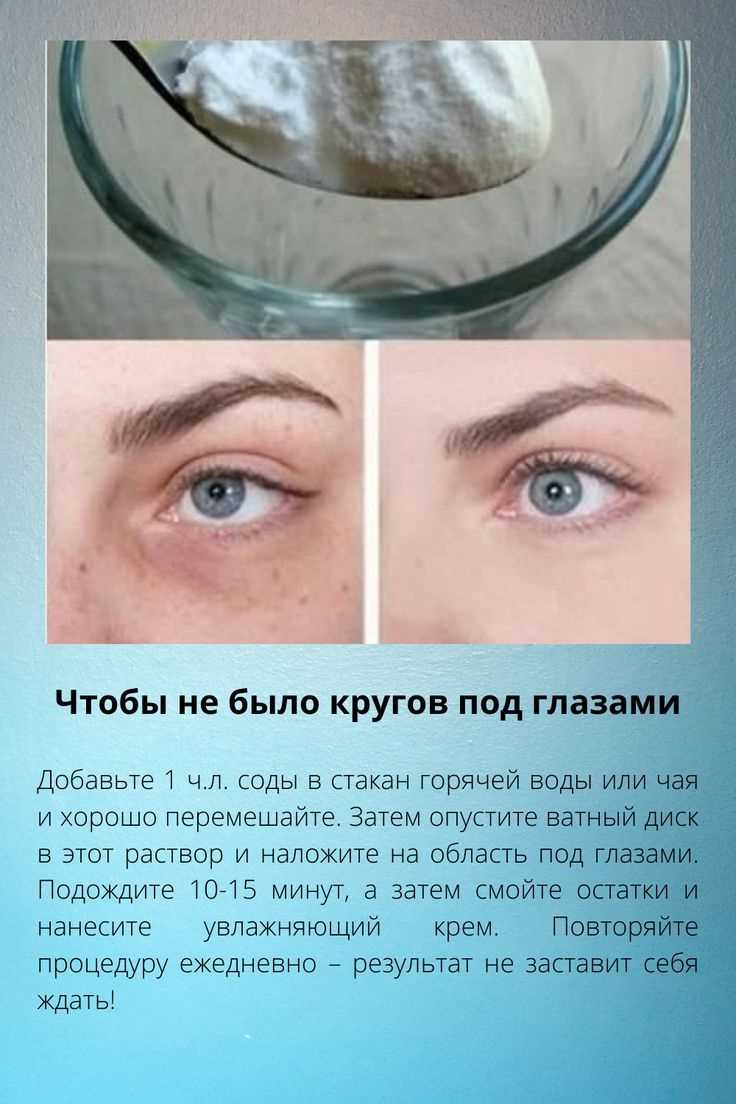 Как навсегда избавиться от темных кругов под глазами