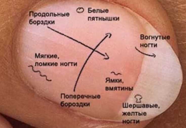 О каких проблемах со здоровьем расскажут ногти? О каких проблемах со здоровьем расскажут ногти?