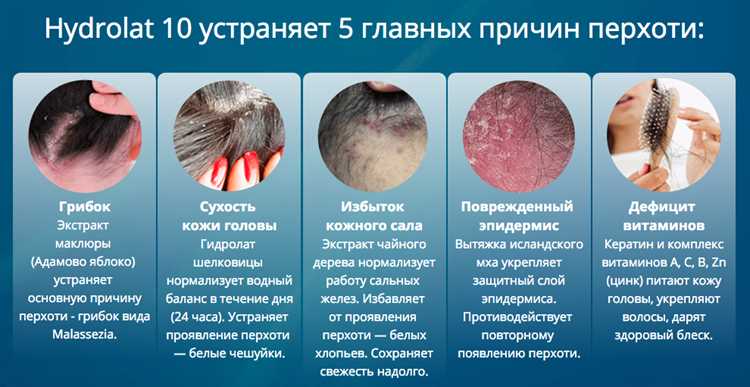 Грибок, который любит вашу голову больше, чем вы