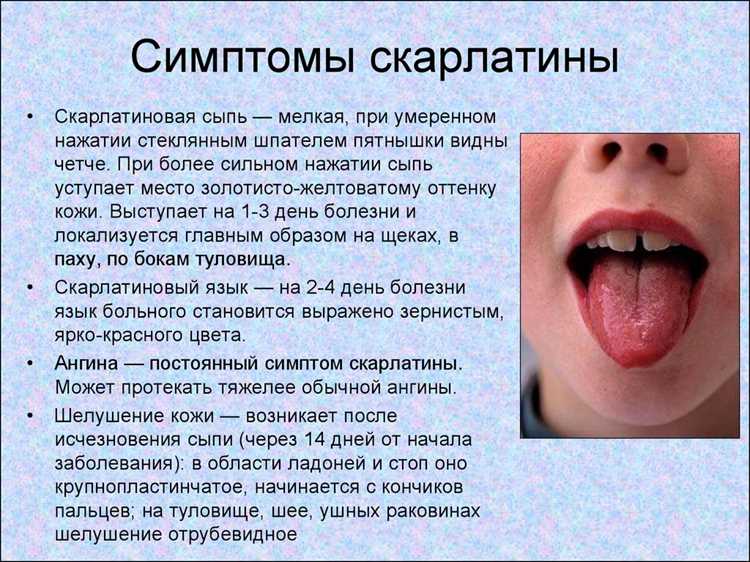 Как не допустить заражения: профилактика наше все